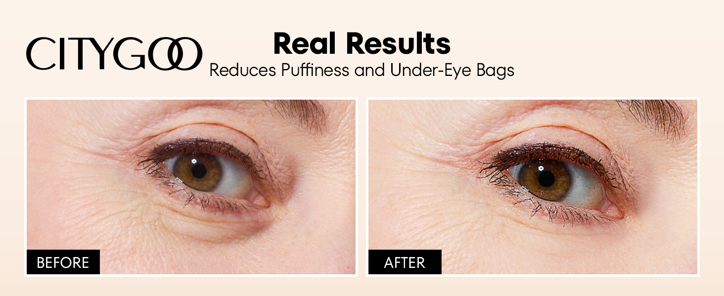 Citygoo Before and After Results