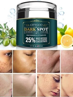 CITYGOO Dark Spot Remover for Face: Dark Spot Corrector Cream - Enriching Skin Care For All Skin Tones - Melasma Freckle Sun Spot Remover & Blemish Reducer-1.7 FL OZ