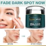 CITYGOO Dark Spot Remover for Face: Dark Spot Corrector Cream - Enriching Skin Care For All Skin Tones - Melasma Freckle Sun Spot Remover & Blemish Reducer-1.7 FL OZ