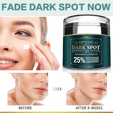 CITYGOO Dark Spot Remover for Face: Dark Spot Corrector Cream - Enriching Skin Care For All Skin Tones - Melasma Freckle Sun Spot Remover & Blemish Reducer-1.7 FL OZ