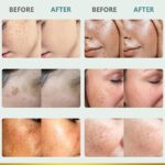 CITYGOO Dark Spot Remover for Face: Dark Spot Corrector Cream - Enriching Skin Care For All Skin Tones - Melasma Freckle Sun Spot Remover & Blemish Reducer-1.7 FL OZ