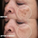 CITYGOO Dark Spot Remover for Face: Dark Spot Corrector Cream - Enriching Skin Care For All Skin Tones - Melasma Freckle Sun Spot Remover & Blemish Reducer-1.7 FL OZ
