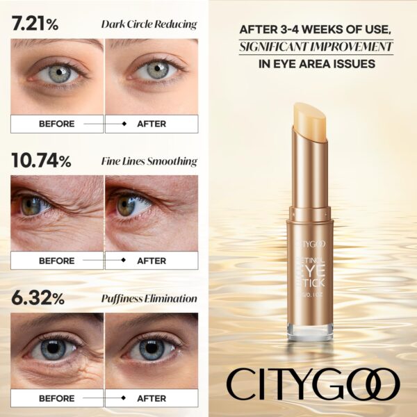 CITYGOO Retinol Eye Stick With Collagen, Hyaluronic Acid For Dark Circle, Under Eye Cream Anti Aging, For Puffiness and Bags Reduces Fine Lines (Retinol Premium Gold Edition 3g)